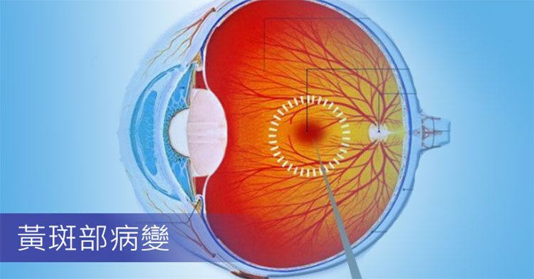 潛在的眼科應用